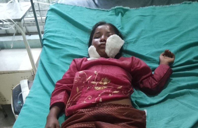 आठविसकोटमा जिप दुर्घटना हुँदा १९ जना घाइते, केहीकाे अवस्था गम्भीर 