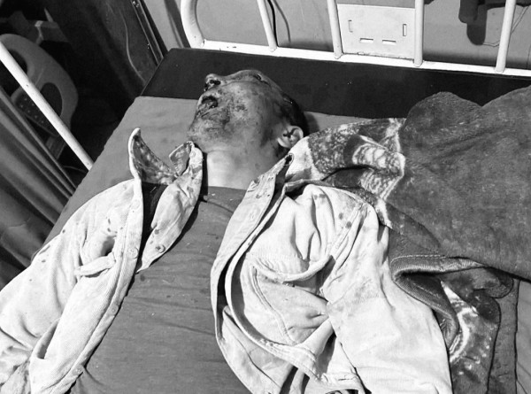 त्रिवेणी १० टोट्केका विनोदको लडेर मृत्यु