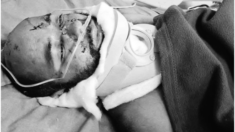 सल्यान दुर्घटनामा गम्भीर घाइते ठगेन्द्रको पनि मृत्यु, मृतकको सङ्ख्या ५ पुग्यो 