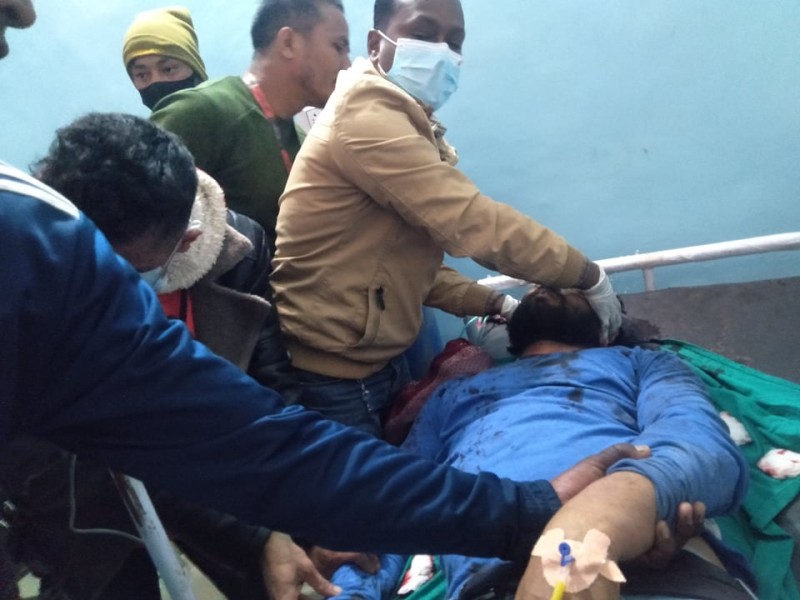 आठबीसकोट घटनाः ६ घण्टा लगाएर चन्दको टाउकाेको अप्रेशन 