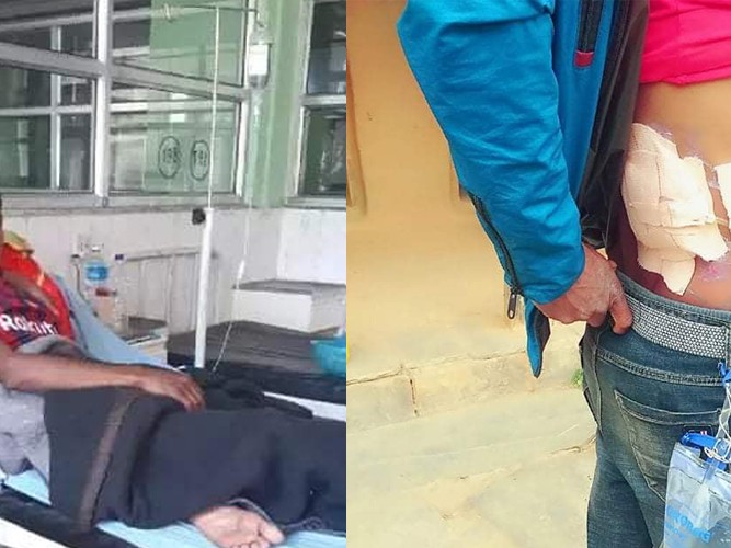 मृगौला पिडित जगतको उपचारका लागि सहयोगको याचना 