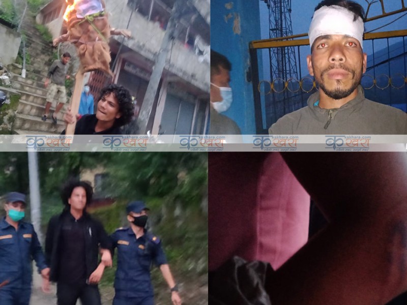 राष्ट्रपति र प्रधानमन्त्रीको पुत्ला दहन गर्ने विद्यार्थीमाथि प्रहरीको लाठी, ३ जना घाईते, १५ बढी नियन्त्रणमा   