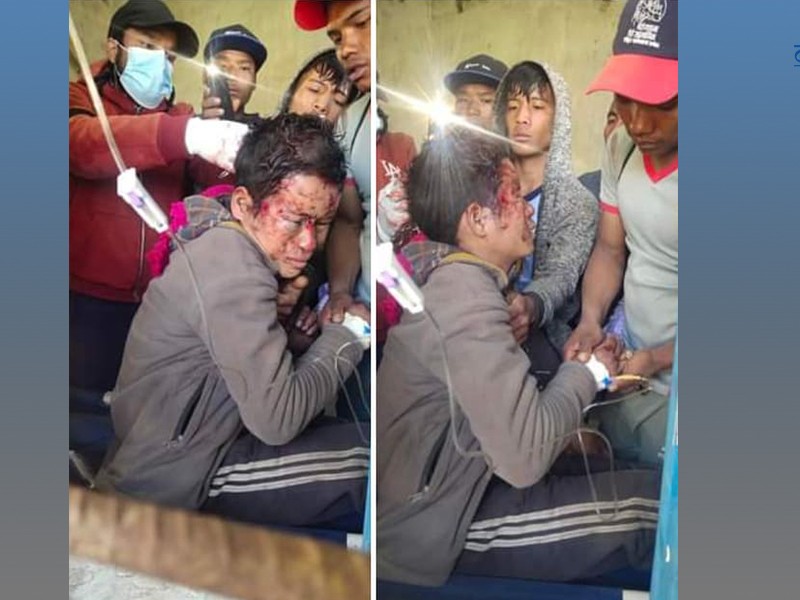 बिद्युत विस्तारमा खटिएका कामदार पोलबाट खसेर घाइते 