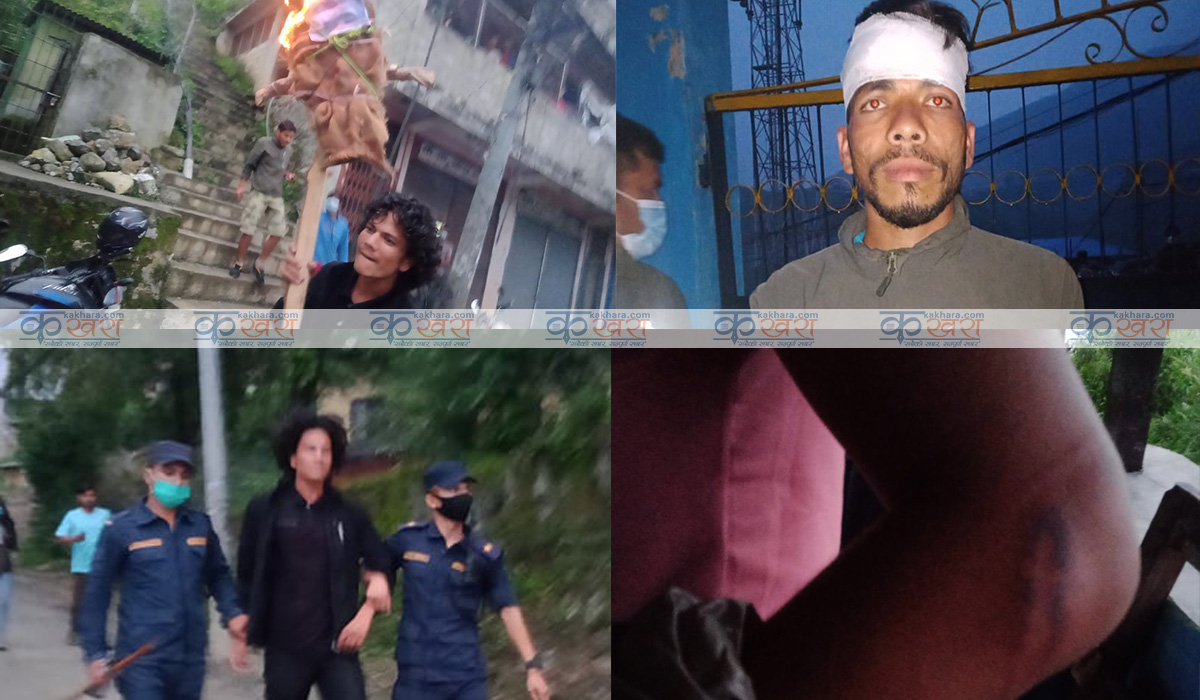 राष्ट्रपति र प्रधानमन्त्रीको पुत्ला दहन गर्ने विद्यार्थीमाथि प्रहरीको लाठी, ३ जना घाईते, १५ बढी नियन्त्रणमा   