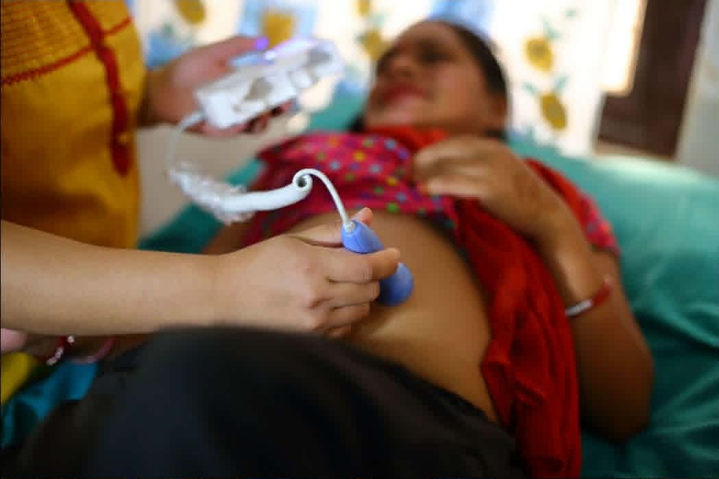 संस्थागत सुत्केरी सेवा घट्दै, किशोरी आमाको प्रतिशत बढ्दो